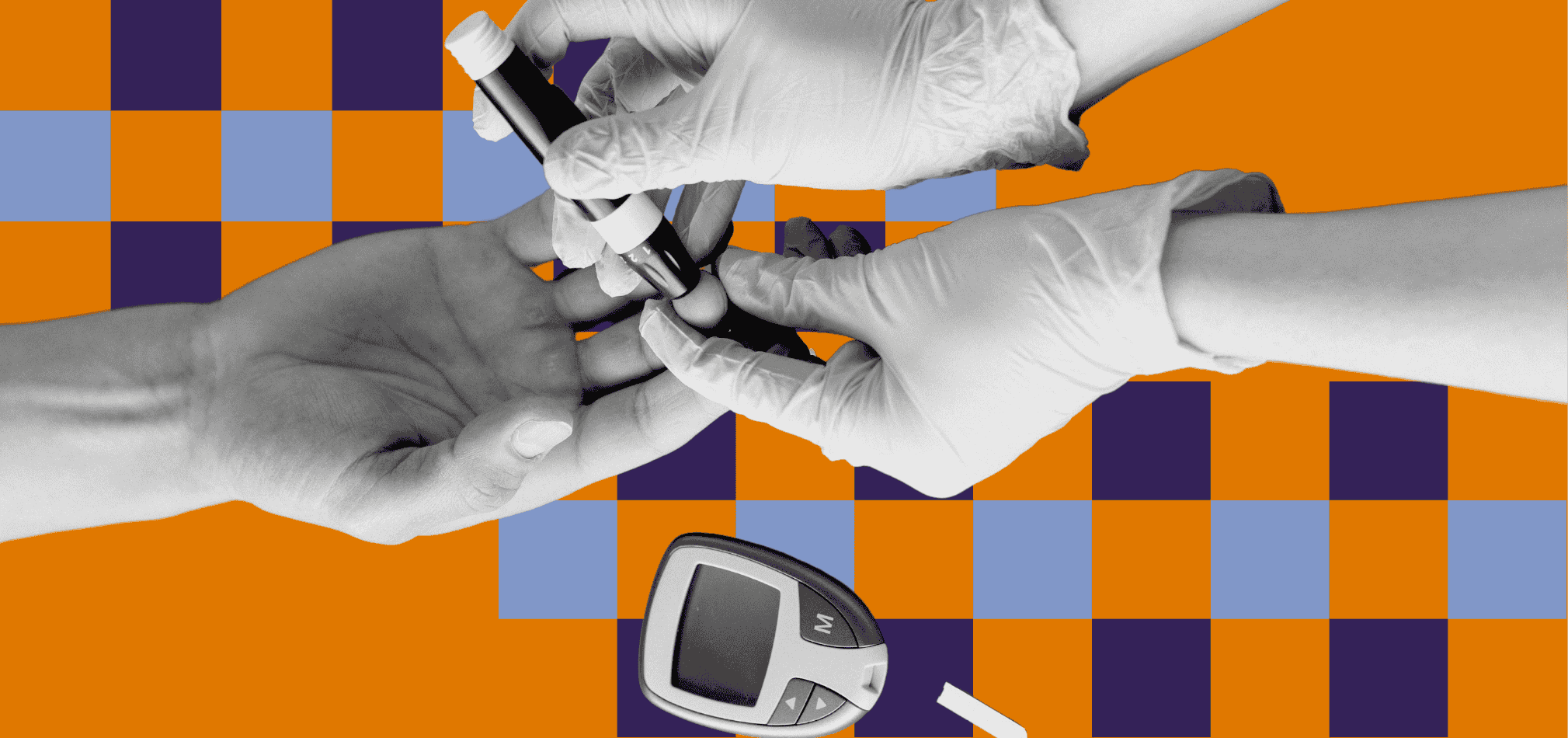 A high utilization diabetic patient is an example of a patient that would result in an outlier payment.