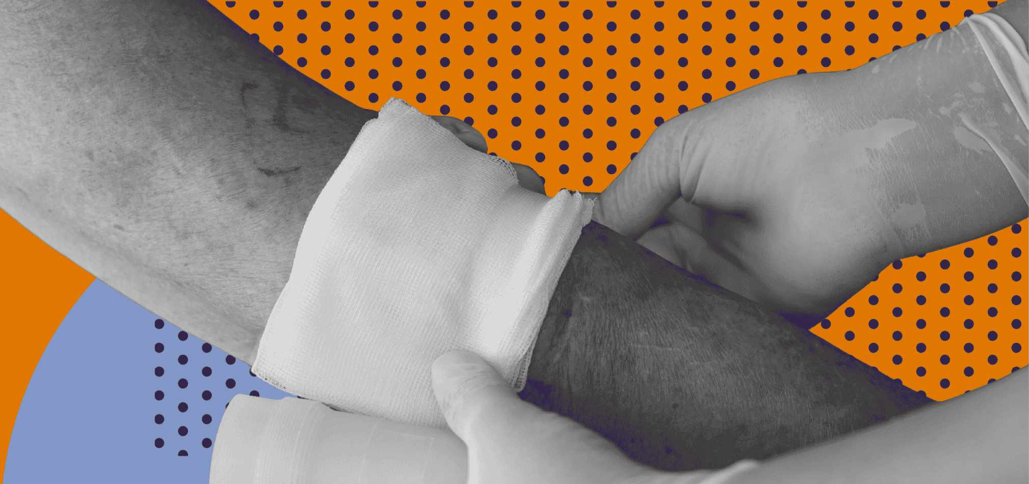 A home health clinician is taking care of a pressure wound.